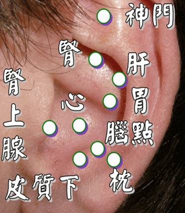 耳穴